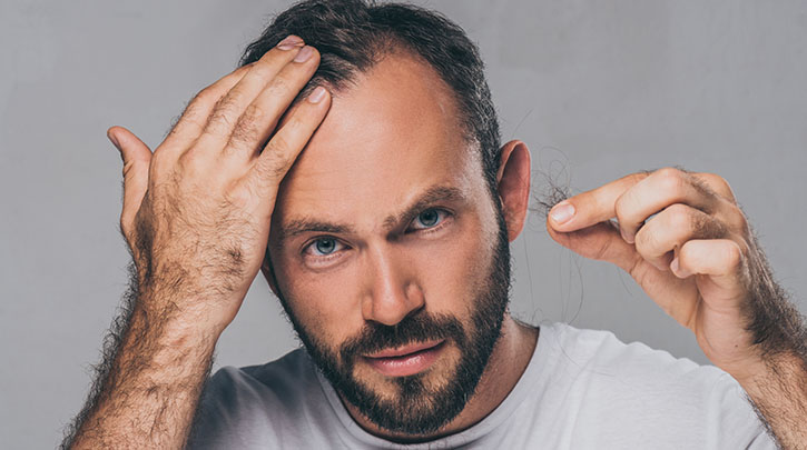 The Best Time To Do Something About Your Hair Loss Is Now
