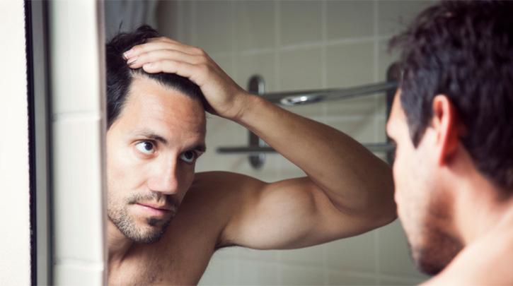 Top 10 Myths About Hair Loss