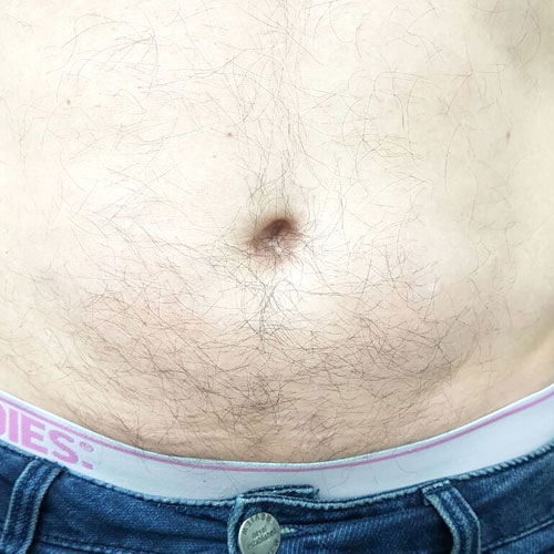 Original Image