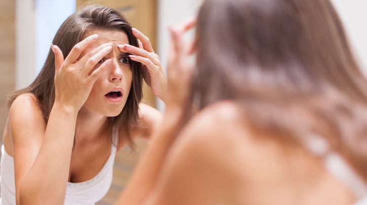 10 Surprising Causes of Adult Acne Breakouts