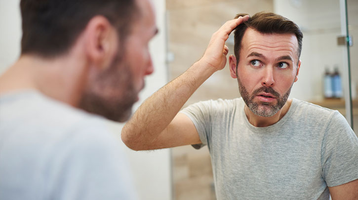 How Do I Help My Husband with Hair Loss?