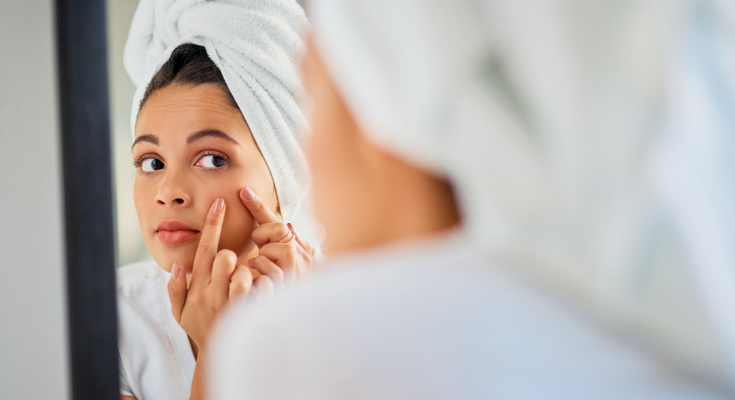 How You Might Be Making Your Acne Breakouts Worse