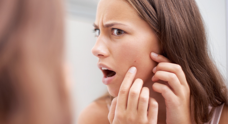 The Link Between Diet and Acne Breakouts